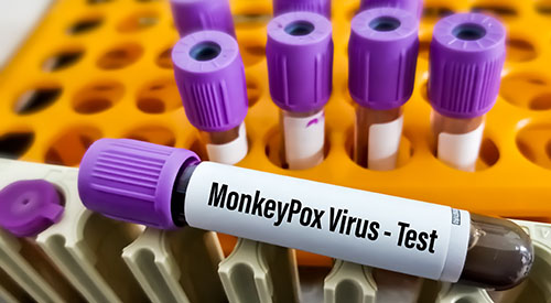Monkeypox Virus Test Web Banner
